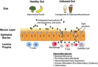 The Role of Carrageenan and Carboxymethylcellulose in the Development of Intestinal Inflammation